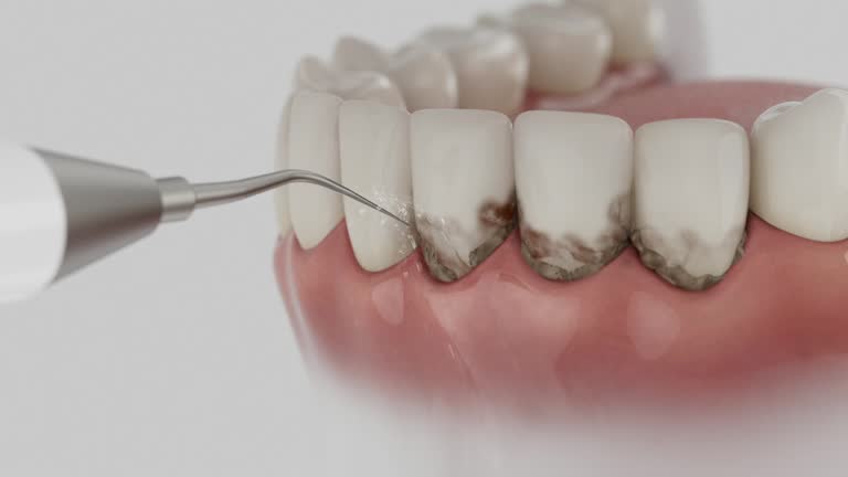 Reliable Tooth Extraction contractor in Aroostook County County, ME by Dentist Open Now